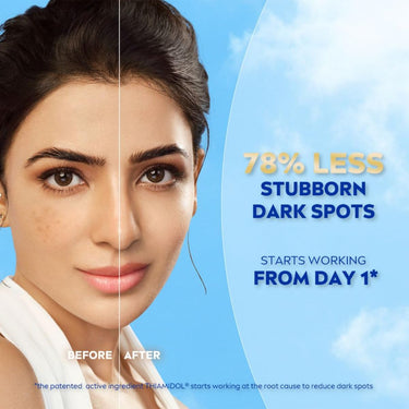 NIVEA Luminous Even Glow Oil Control Face Serum with Thiamidol (60X more effective than Vitamin C), Salicylic Acid, Hyaluronic Acid, Green Tree extracts for Dark Spots Reduction & Hydration| 10ml